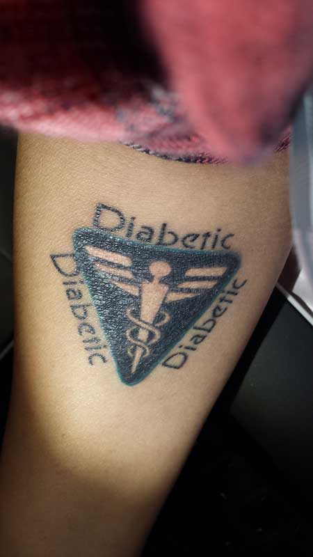 diabetestattoo005kl